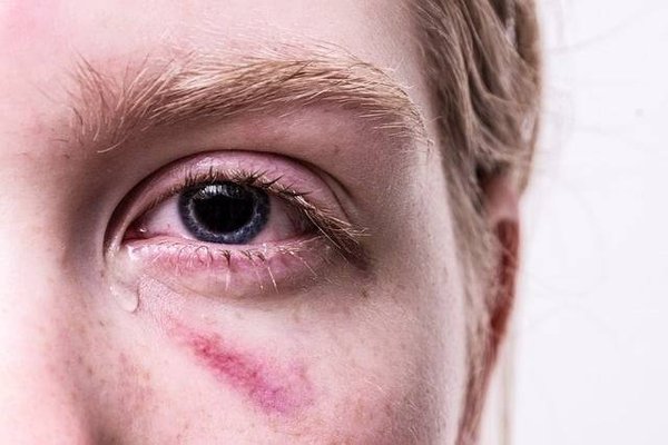 Gestes essentiels en cas de traumatisme : Votre guide pratique de premiers soins
